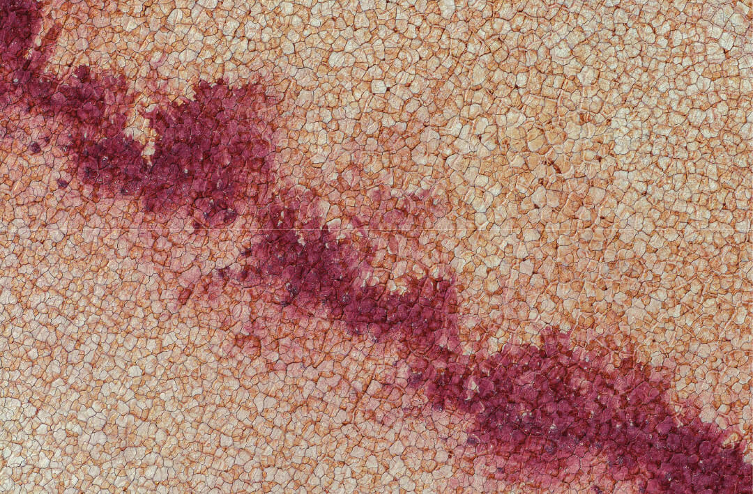 Eczéma, Psoriasis et Peau Sensible : Guide Zone par Zone (Bras, Mains, Coudes, Jambes et Plus)