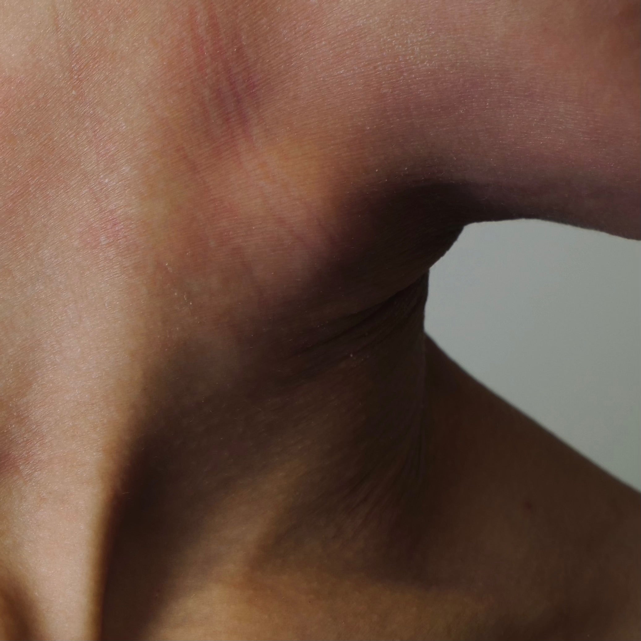 Photo macro d’un pli de peau sensible présentant de légères rougeurs, illustrant la fragilité cutanée et les besoins de protection textile deuxième peau®.